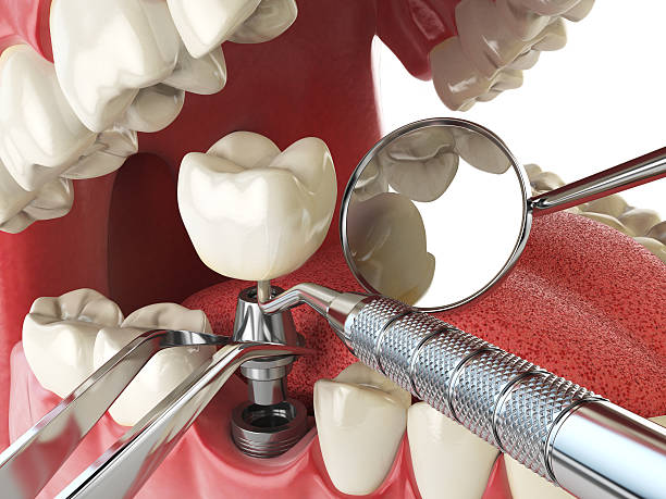 Best Emergency Denture Repair in Linntown, PA