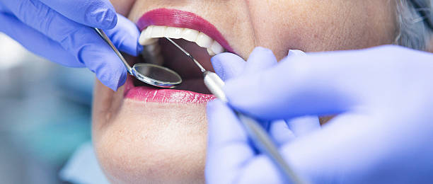 Best Emergency Cosmetic Dentistry (e.g., broken veneers) in Linntown, PA
